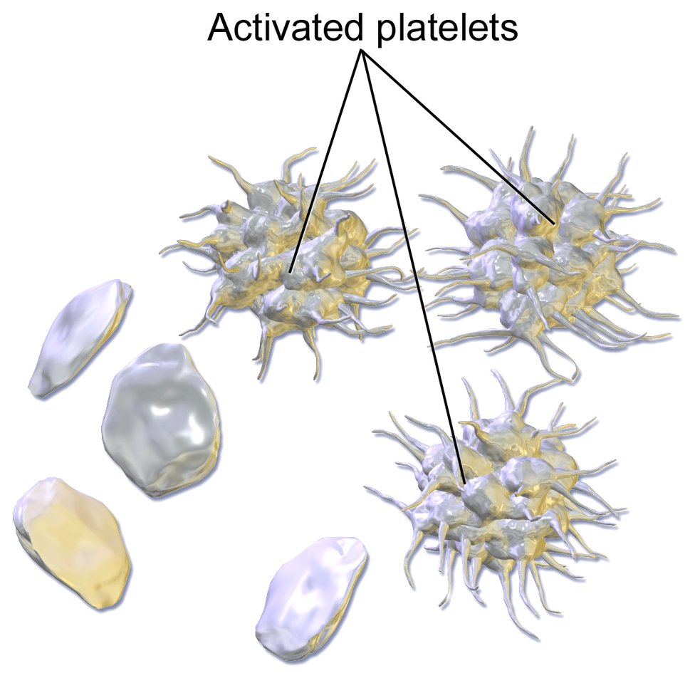 A medical illustration of smooth, disc-shaped resting platelets beside spiky activated platelets, the shape they take as they grip each other to form a clot.